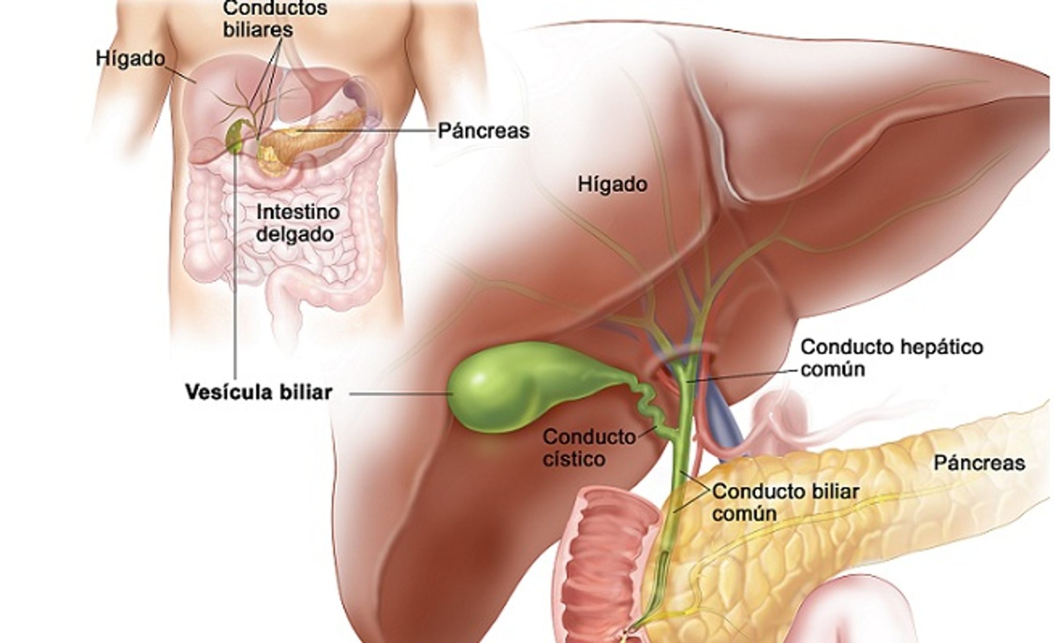 How Often Do Gallstone Attacks Occur